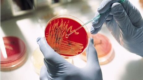 cultura bacteriana para prostatite para prescrever antibióticos