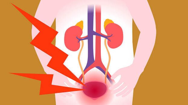 dor na área da bexiga com prostatite aguda